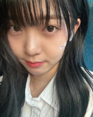 Hong Seung-hee Instagram - 밴드는… 뾰루지랑 싸워서 짐🤦🏻