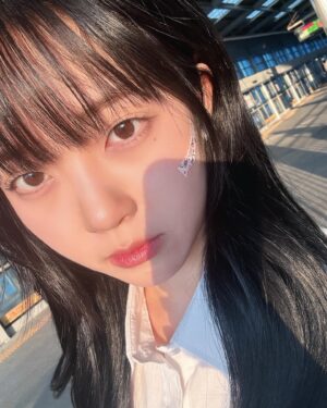 Hong Seung-hee Instagram - 밴드는… 뾰루지랑 싸워서 짐🤦🏻