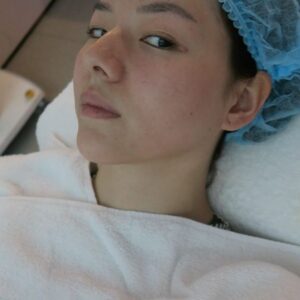 Jasmine Sim Instagram - been almost 6 months since my first #Ultherapy treatment at @sw1clinic and I’m still loving it 🥳

was curious about this treatment for quite a while already and turning 30 last year, I thought… LETS DO IT!! and I’m so glad I did. Wasn’t ready for anything invasive yet but I wanted a lift especially since I felt like my cheeks were getting a bit heavy/ saggy and wouldn’t say no to a more defined jawline too. was told the results will typically show in 2/3 months and last for a year. To be honest I think even before the 2 months mark, my manager saw me in person and said something looked different (better of course) and I have to give full credit to this cause I don’t think I did anything else different! 

Pain wise it was surprisingly alright for me. Watched quite a few videos and read up on this before my session and was expecting it to be a lot more painful. Even had a squishy for me during the treatment but I ended up just chatting with my doctor throughout. Some areas were definitely more sensitive than others but nothing unbearable. 

Honestly can’t wait for my one year anni so I can do another session! is this addiction??🙈

@merzaesthetics.sg