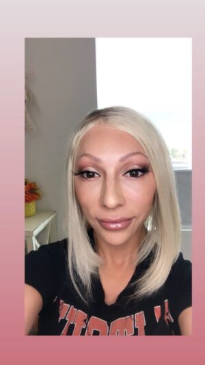 Jasmine Arteaga Sorge Instagram - Thank you @cosmeticare_ for helping me feel and look my best. @dominika_rn is so gentle and so honest about  what I need. Botox takes about 2 weeks to see the final results. You can see when she marks me up my wrinkles are more pronounced and as the days go on it does it’s magic. If it’s not for you it’s okay, but it’s definitely for me. #botox #beauty #doitforyou check out my link for  NEW client specials!! Xoxo 😚