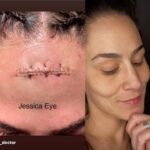 Jessica Eye Instagram - I hope everyone had a wonderful Easter Sunday🐇🙏🏼❤️ This past year has had so many blessings good and bad 😂 I am happy to count my blessings on a daily basis and reminding myself that scars do heal. If you need a visual reminder for extra motivation. 😵 😂 at times its just as simple as looking in the mirror and Smile 😍 Two stitches on the inside and 17 on the outside ! You know I Handled it like a champ too didn’t I @keebleristinyxoxo If you seen the fight it was intense and bloody. Scars do heal . . Thank you @the_ufc_doctor 🥼🩺 . #ufc #jessicaevileye #retired