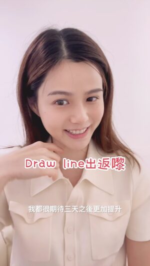 Jessie Fong Win-Lam Instagram - 其實我喺結婚之前真係做咗好多嘢，其中”小顏術”係必做！佢令到我塊面立體咗，對稱啲，仲細啲添🥰 所以一定要介紹俾你哋，我仲幫大家攞到以下嘅優惠😁👇🏻

優惠1 ⭐️日本筋膜小顏術(臉部) 試做價 $480

優惠2 ⭐️日本筋膜小顏術 (臉部 眼部) 試做價 $760
送【日本降壓頭療 】一次 價值$500
送 韓國Liftera無針埋線4.5頭600發 價值$1800

優惠3 ⭐️日本筋膜小顏術 HK$6800/12次 (臉部)
送 醫學美容儀器療程一次 價值$1500

DM我就攞到優惠😉