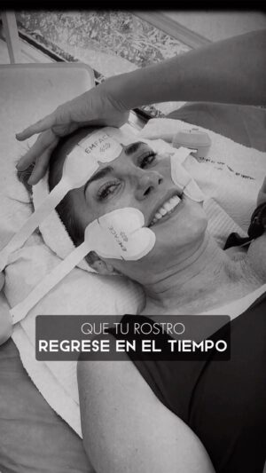 Karina Calmet Instagram - REJUVENECIMIENTO FACIAL DE HOLLYWOOD
¡EN 20 MINUTOS!

Con este protocolo exclusivo de STETIC SMART, puedes decirle adiós a la flacidez no sólo de la piel sino tambien la #EmFace le da estructura muscular para tener un resultado el mismo día del tratamiento, sin inflamación ni ematomas. Y potenciamos más su efecto con #Aesthefill para estimular la cantidad de colágeno y elastina en el rostro. 

Siempre usando la alta tecnología inglesa BTL con protocolos aprobados mundialmente.
Escríbenos o llámanos y resolveremos todas tus dudas.
¡Te esperamos!

Contáctanos:
✅ Sede Miraflores: Av. República de Panamá 6372
2287356 - 917505413

- Convenio con Diners y Bbva hasta 6 y 12 cuotas sin intereses o con cualquier medio de pago.
Clínica Oficial del Miss Peru Mundo LI
#estetica #rejuvenecimiento #tratamientoestetico
#steticsmart #lima #limaperu #trends #EMFACE #Nolnvasivo