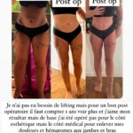 Kelly Helard Instagram - Vous l’avez compris, j’ai repris une activité à temps plein entant que Community manager en cdd et je l’espère en cdi dès septembre. J’ai réalisé une vidéo qui explique mes missions . J’ai voulu vous l’annoncer mais je ne parlerais pas forcément de mon travail ici car je partage ma vie sur cette Instagram que ce soit activités avec mes enfants ou les tournages de mamans et célèbres ou encore mon sport mon alimentation …. Et pleins d’autres choses . Par contre je parlerais de la maladie sur le compte : @lipoedeme.france je rappelle que c’est une maladie qui est reconnue par l’OMS dont beaucoup trop de femmes souffrent . Ce n’est pas de l esthétique mais bien une maladie avec de réelles douleurs.