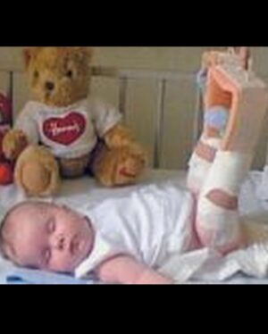 Kerry Ingram Instagram - Happy wishbone day! Today is the day we wear yellow to raise awareness for #OsteogenesisImperfecta, a genetic condition I was born with that causes bones to break easily along with many other side effects and challenges.

The third picture is of me at 6 weeks old. There wasn’t much information on OI at the time, which led to my mum being accused of abuse before someone familiar with the symptoms recognised it and had a diagnosis. Doctors at this point had no idea which type I had either and all they said was “it can be fatal, if not she probably won’t be able to walk”

well I’m still here and walking! (Maybe even skipping if I’m feeling boujee) - which is thanks to the miracle that is modern medicine (not yoga, like someone on Instagram suggested... or milk, like someone on twitter suggested) - yikes🤦🏼‍♀️ Sending love to all my OI fam 💛 
#wishboneday