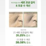 Kim Ji-hye Instagram - 공구시작 . 리들샷 100~300~700 중독이야 . 약한거 말고 . 내피부를 확실히 변화시켜주는~~~ . 나이들수록 각질탈락 안되고 . 느려지는 피부재생 주기 ㅜㅜ . 리들샷으로~~관리해 보아요~~