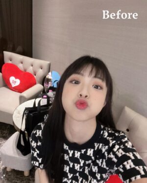 Li Chun Cho Instagram - -不是變瘦了！
是我去打肉毒消滅咀嚼肌啦！

太喜歡吃東西有時候也是一種困擾～
因為我的咀嚼肌實在太猖獗了ಥ_ಥ
所以這次果斷去聖宜 @saint.eir 消滅它！

聽說注射的時候會酸酸的～
但醫師真的好溫柔😂
所以其實我覺得還好（也有可能我神經比較大條XD)

愛美的男女生們～真的！不會後悔～
打了肉毒後臉的線條自然又好看🤣
推推(｡ì _ í｡)

可以繼續吃了（？

#聖宜診所 #聖宜忠孝 #精雕細琢完美你型