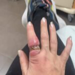 Loana Petrucciani Instagram - Ça c’était avant l’opération 😱 😰 loana #beauty ##frenchgirl #miroir #naturalmakeup #loveyou #influenceuse #romantic #women #selfie #love #heart #sweet #friends #blondebombshell #love #heart #sweet #friends #blondebombshell #🧡