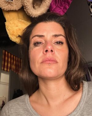 Mafalda Luís de Castro Instagram - Só deixar aqui uma tristezazinha para normalizar os dias maus. Ninguém pediu e ninguém quererá saber, mas eu sei que tanto sorriso, festa, amigos, e aparente felicidade podem ajudar ao pensamento erróneo de que as suas dores não são normais. 
Eu sou feliz, momentaneamente, como todas/os. A tristeza, frustração, ansiedade, raiva, medo, culpa e demais sensações más, estão todas cá, todos os dias. Mas não nos apetece tirar fotos nesses momentos, não é? (Meio que me senti ridícula, mas olha…foi a pensar no quão embusteiro pode ser um feed cheio de brilho e aparente harmonia). 
O mundo a apodrecer e eu ia ser só feliz? Não. Ninguém… Impossível.
Aqui, tinha chegado de um dia de espectáculo e, por uma situação menos boa, precisei de chorar (a última imagem é da manhã seguinte). Ter conseguido foi libertador porque aqui a nina tem MUITA dificuldade em abrir a torneirinha. Só quem é assim, sabe o alívio que é conseguir verter uma lagrimita 3x ano. 😂 
Às vezes apetece-me bater voluntariamente com o mindinho do pé na quina do hall da casa para ver se ela aparece. A puta da lágrima!
E a quantidade de vezes que já pus a banda sonora pesadona da vida para que saiam mais umas quantas? (Afff, socorro, ajudem as duronas que só querem ser mais frágeis)!! Mas quando vêm, vêm com tudo! Que bom. ❤️🥹 
Gostava de chorar mais.😊💦

(Deixo uma song das minhas mais usadas em situação de emergência, o meu querido e sempre útil Thom Yorke - Dawn Chorus).

#maislágrimaspfv