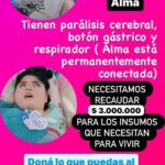 María Valenzuela Instagram – Alma y Milo nos necesitan, logramos recaudar lo del mes de enero ahora necesitamos ayudarlos para pagar sus tratamientos en el mes de febrero debido al aumento de los insumos debemos recaudar $3.000.000 Dona lo que puedas alias AYUDAR.SALVA