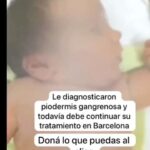 María Valenzuela Instagram – Juanita hoy padece piodermis gangrenosa y debe continuar su tratamiento en Barcelona. Necesitan pagar su alojamiento allí. Difundi y ayuda con tu granito de arena a Alias: ayudar.salva Gracias a todos los que siguen ayudando 🙏🏻🙏🏻🙏🏻