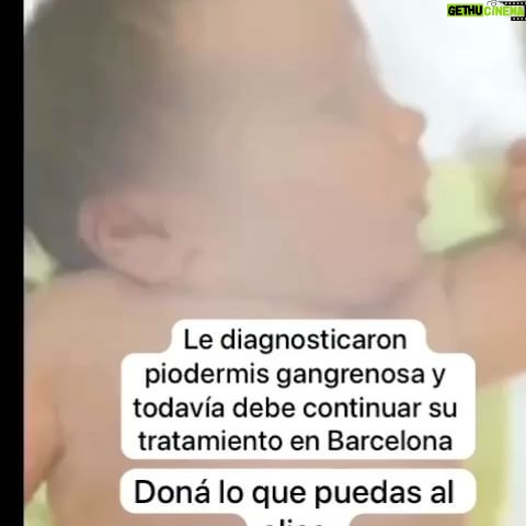 María Valenzuela Instagram - Juanita hoy padece piodermis gangrenosa y debe continuar su tratamiento en Barcelona. Necesitan pagar su alojamiento allí. Difundi y ayuda con tu granito de arena a Alias: ayudar.salva Gracias a todos los que siguen ayudando 🙏🏻🙏🏻🙏🏻