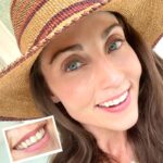 Mary Padian Instagram - Toodle-oo Teeth Stains & Hello There Pearly Whites! Friends, I'm here to tell you about my Remi Custom Teeth Whitening Kit! @remitribe I've been using it for 2 weeks now and been LOVING the results (see before & after photo)! I used to buy teeth whitening strips but they made my teeth and gums so irritated and sensitive. A friend recommended Remi’s kit because their whitening gel is made of high quality vegan ingredients & is safe for overnight wear. So, I had to try it and I'm so glad I did.  The process was super easy - I ordered online, did an impression kit from home, and the Remi team sent me back ultra-comfortable custom teeth whitening trays with plenty of gel. Then, before getting into bed I put a thin layer of whitening gel in the trays and I’d forget they were there by the time I fell asleep. The Remi custom whitening kit brightened my teeth better than any other method that I’ve tried and I didn’t experience any tooth sensitivity. I am so happy with the results and couldn’t recommend it more. Go to shopremi.com and use code: MARY25 at checkout for 25% off today. This special offer is only available until Sept 25th! You’ll thank me later! Link in bio!  #sponsored #remi #shopremi #teethwhitening #marysfinds #teeth #whiteteeth #covid_19 #smile #smilemakeover #oralhealth #whitening #pearlywhites #teethwhiteningkit #whitesmile
