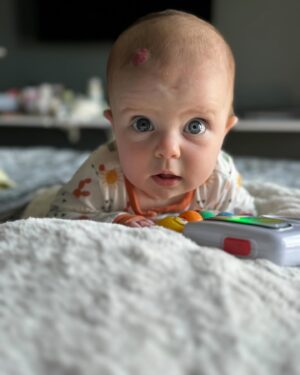 Matilde Breyner Instagram - 6 meses, meio ano, merece um registo com uma fotografia por cada mês de vida 🎂
O passatempo preferido é observar pessoas, como a Mãe, e tem o bom feitio do Pai. Dos três, acho que é quem tem o sentido de humor mais apurado. Adora água e quando não gosta de alguma coisa é só tocar a Baby Beluga (tem de ser a versão do Raffi) que o amuo passa logo. 
Nasceu com um sinal morango 🍓 (como os médicos lhe chamam) na cabeça, que tinha a forma perfeita de um coração quando começou a crescer. Vai desaparecer lentamente mas também não temos pressa… 
É verdade quando dizem ”aproveitem porque passa tão rápido”. Nós estamos a aproveitar e a saborear cada segundo da melhor coisa do mundo.
