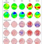 Maycee Barber Instagram - In tune with my brain and body 🧠 @airestech brain mapping is NEXT LEVEL. I learned a lot about how my brain functions and how it can affect my body. Being a professional athlete, it is SO important that I optimize my performance - especially as I approach my next fight. 🥊 This session solidified and validated my intuition since I’ve been using the products, and seeing it happen in real time was crazy. 🤯 I mean…just take a look at those scans 👀 #airesathlete