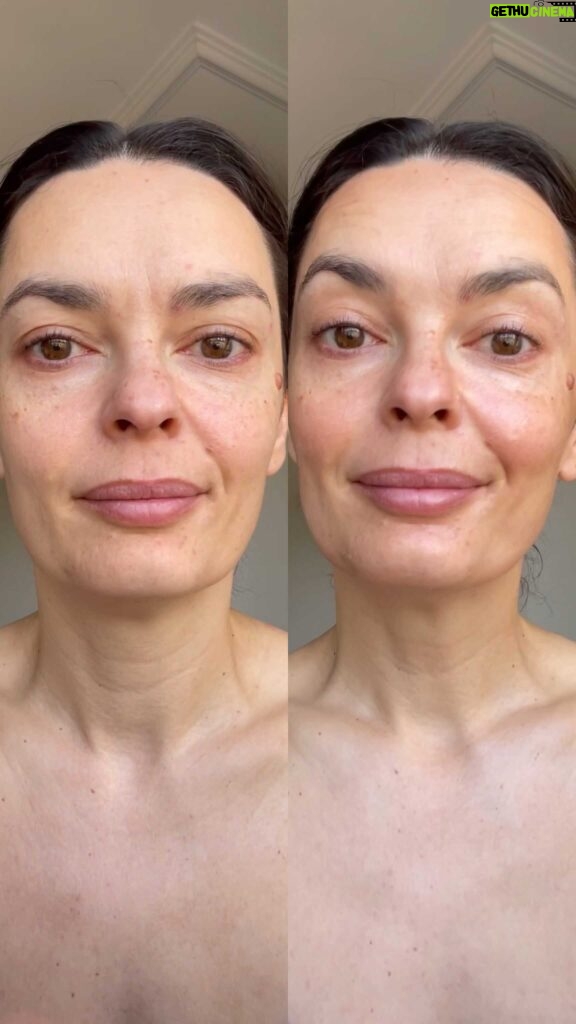 Melânia Gomes Instagram - Antes e depois... Conseguem perceber as diferenças, certo? A minha pele também, depois de ter começado a usar os produtos personalizados de skincare da @mahg.pro , já não quer outra coisa. Até modelar o rosto e corrigir imperfeições eu consigo fazer, sem maquilhagem. Tudo só com os produtos de skincare! Cada pessoa é única, cada pele também e a @mahg.pro faz cada produto especificamente para ti, conforme as características da tua pele, aproveita! Marca uma consulta on-line, para a partir daí ser possível desenvolver os teus produtos, conforme os teus objetivos, as características e necessidades da tua pele. Isto é único! ✨🤍 #skincare #parceria #rotinadedia #personalizada #simples #minimalista #vegan #crueltyfree