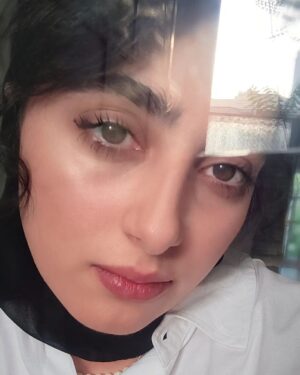 Melika Shaban Instagram - پس از عمل لازک چشمم 🤍😊