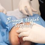 Meriam Bellina Instagram - Treatment Tarik Benang dengan inovasi terbaru di @klinikdermaprojakarta ? Apa si beda nya dengan benang yang lain? - Benang terbaru denga tarikan yang lebih kencang dan awet tahan lebih lama - Benang di desain sesuai dengan bentuk wajah sehingga tidak mudah putus - Menggunakan teknik terbaru sehingga pasien akanmendapatkan hasil yang jauh lebih maksimal 📞 Phone: 021 567 0627 Whatsapp 1: 0878 8541 8969 Whatsapp 2: 0819 0506 3853