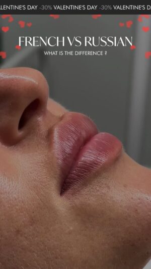 Nadège Lacroix Instagram - Do you see the difference ? 😉 
But we do! 

Book your Best Lips Enhancement appointment with us and get -30%OFF! 💉💋

✅ Drop « » in the comment, and we’ll send your -30% voucher in DM!

Or 

📱 Go to our stories and Reserve your digital voucher, stock is limited! 

This offer is valid till  February 15 , but the voucher should  be used before 30 of May 2024. 

Please note that lip enhancement treatments should only be performed by qualified professionals. Consultation is required before the treatment to ensure suitability and safety. Results may vary.

To book an appointment, contact us:

📍 Geneva: Call  41 22 732 22 23 or reach us on WhatsApp at  41 79 931 20 66

📍 Montreux: Call  41 79 908 98 98

📍 Gstaad: Call  41 79 196 98 69