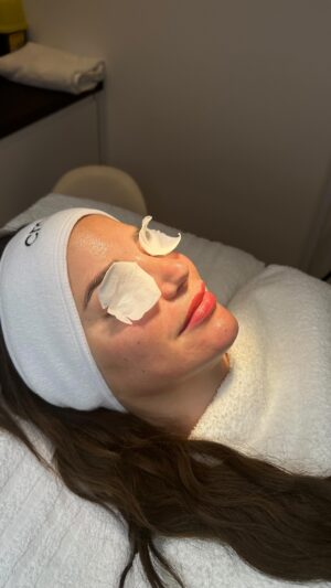 Nadège Lacroix Instagram - NOUVEAU SOIN !

 🌲 Alpine Honey Lift 🍯

En exclusivité chez Aesthetics clinic à Genève & Gstaad

Véritable traitement anti-age aux bienfaits suivants :

ANTIOXYDANT. Riche en antioxydants, acides aminés, vitamines B et C, minéraux et oligoéléments, le miel favorise la régénération de la peau et booste la cicatrisation. Ainsi, il améliore la texture de la peau et permet d’éviter les rides prématurées en éliminant les toxines en profondeur.

Le soin se déroule en plusieurs étapes :

1- Nettoyage de la peau en profondeur 
2- microneedling aux vitamines & acide hyaluronique 
3- Masque Honey Lift Suisse

Offre spéciale : *250 chf* 

Prendre RDV 👇

 * 41 22 732 22 23* 
Ou par whatsapp 
 * 41 79 931 20 66* 

Aesthetics clinic Genève 
18 chemin Rieu 
1208 Genève

#partenariatrémunéré  #aesthetics #aestheticsclinic #geneve #geneva #gstaad #newtreatments #new #treatments #alpinehoneylift #alpine #honey #winter #lift #skin #skintreatment #skincare #skingoals