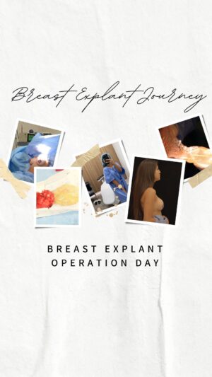 Nathalia Castellon Instagram - I share these videos because I made a deeply personal decision to shed light on the impact and effects of Breast Implant Illness. Undergoing the explant procedure was emotionally and physically challenging, but I wouldn’t trade my decision for anything. I’m new to the YouTube community, so I would really appreciate your support. Please be aware, the content is graphic. @drrogertsai 

🎥: @cam.operator 

#breastexplantjourney #breastimplantillness #bii #explant