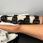Peyton Evans Instagram - I’m in a hinge brace now. Starting PT this week. I’m scared. I’m in so much pain and I don’t want to have to ever have this surgery again. 10 days post op. #aclremovalrecovery #kneerecoveryjourney #kneerecovery #peytonkaye