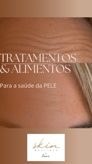 Rita Andrade Instagram - Pele: Alimentação & Tratamentos

A nossa pele é o reflexo do que vivemos, comemos, sentimos e cuidamos. A nutrição deste órgão acontece através dos nutrientes que ingerimos e não existem alimentos “neutros”: cada um ou contribui para as células saudáveis da pele e proteínas estruturais (como o colagénio) ou as destrói e nos envelhece. Existem 2 formas de cuidarmos da pele: alimentação, e dermocosmética ou tratamentos de medicina estética. A nutrição estética é sempre personalizada (faço planos alimentares “anti-aging” caso a caso) mas há algumas bases comuns sabendo que os alimentos de origem vegetal são ricos em compostos bioativos, incluindo vitamina C, vitamina E, betacaroteno, polifenóis e ácidos fenólicos, que podem contribuir para a defesa oxidante, diminuir a inflamação e promover o suporte estrutural da pele.

Quando as rugas se instalam, e se tornam cada vez mais pronunciadas, a toxina botulínica pode devolver o aspecto mais jovem da pele de uma forma rápida, sem dor, com durabilidade de efeitos variável entre 3 a 6 meses e ainda previne a formação de novas rugas pela perda de produção de colagénio natural da idade. 

Aqui podem ver que a minha testa ficou MUITO diferente e eu mais feliz depois de ter ido a Skin Boutique e ter tido a consulta com a Dra Mafalda Cleto 🙏 🤗 Apesar de ter uma alimentação saudável, os 42 já chegaram e com eles trouxeram-me estas rugas que eu não gostava mesmo nada!

Vou continuar a cuidar da minha pele através da alimentação e dos tratamentos mesmo muito bons que a @skinboutique tem (são vários e muitos nutrem a pele com vitaminas de forma profunda.. mas vou aqui partilhando o que faço).

E por aí? Já beberam os vossos 2 Lt de água, comeram os vossos vegetais e frutas e cuidaram da vossa pele hoje?

Beijinhos da nutri ❤️

#skincare #skinboutique #botox #pele #saude #nutriscience #mindwhatyoueat