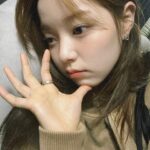 Rothy Instagram - 왼쪽 코옆에 왕뾰루지가났다. 오른쪽으로 걸어다녀야지.
