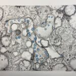 Sarah Pidgeon Instagram – My mom @juliecaroff captured the transmission electron microscopic image of COVID-19 with charcoal pencil, graphite powder, water color, and colored pencil for an assignment in one of her classes.
She allowed me to post this but told me not to write anything “gushy”.
I think it looks pretty close to the real thing, and I’ll leave it at that.