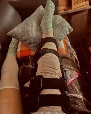 Savannah Kristich Instagram - july 19, exactly two months ago today, i tore both my ACL and medial meniscus. i had done a back aerial and once i landed on my right leg, my knee had completely inverted on heavy impact. once it happened i fell to the floor and just laid there. i didnt cry or yell, but i laid on the ground breathing extremely hard. when people ran over to see what was wrong, they helped me sit up and calm down. at first, i really thought that i was going to be okay and at worst it would just be a sprain. the following weeks after, i made sure to rest and elevate in hope that it was going to get better. however, things weren’t looking too good.my swelling was not going down, i couldn’t straighten my leg, and i was in constant pain. the first visit with the doctor informed me that there was a possibility that my acl had torn, but to take that info with a grain of salt. the doctor had told me that i needed an mri to get a clear answer as to what was wrong. as i waited for the results, i felt like my knee was getting better. i was able to put pressure on it, and i had really thought that nothing severe was wrong with it. but when my mom had told me the news of tearing not only my acl, but also my meniscus i immediately broke down. in that moment it felt as though my world had crashed. dance is the love of my life, and it is the one thing that makes me feel something. all of my dreams of going away to college for dance, performing, and moving forward in my career felt like they were thrown out the window. i couldn’t imagine the thought of going through surgery, completely retraining my leg to function, and not being able to dance for 9 months.as i waited for surgery, i worked on pre-op training all on my own to be able to bend my knee 120 degrees again as well as straightening it. over the course of time, i was walking again and gained back most of my flexion in my leg, but it was incredibly painful. today i had my surgery, and i was scared to death.but i woke of from the operation and was told that my surgery went extremely well. now i am on the road to recovery and trying to keep a positive outlook. God is good and things will get better❤️‍🩹