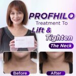 Sazzy Falak Instagram - Taking care of your face doesn’t show your age, but you know what betrays you? Your neck! Neck lines and wrinkles reveal your true age, but don’t worry—treatments like Profhilo can be done on the neck to reduce neck lines, tighten the skin, and refresh it. Always remember to scan the QR code on the Profhilo box to verify its authenticity. Mother’s Day is over, but you can still treat them as our promo is until month-end! Book your Profhilo treatment with us today! ✨ @profhilo_sea #ProfhiloSEAMothersday #ProfhiloforNeck #ProfhiloSEA
