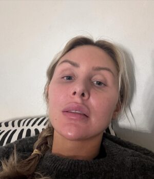 Sointu Borg Instagram - Koska ylisuorittamisen romantisointi on ysäriä, tässä mun TOP-keinot suojella omaa jaksamista, kun meneillään on tiiviimpi työputki. 

1. Tuotan pettymyksiä. Tuotan niitä päivittäin. Pyrin olemaan sinut syyllisyyden kanssa. Kieltäydyn ystävien kahvikutsuista, en vastaa puhelimeen, jätän osittain whatsappia ja s-postia purkamatta. Jos joku kuolee tai syntyy, tieto saavuttaa minut kyllä. 

2. Kuplaudun ja olen ajankäytöllisesti super itsekäs. Tämä sinänsä linkittyy kohtaan numero yksi. Mikäli asia ei ole akuutti, jätän reagoimatta. Kuplautumiseen kuuluu omalla kohdalla se, että laitan luuria lentotilaan ja keskityn vaan siihen, mitä sinä päivänä teen. Moni kysymys ja asia jää roikkumaan. Regoin vaan kriittiseen. En seuraa tiiviisti uutisia ja yritän olla syyllistymättä siitä, että yleissivistykseni rapautuu.

3. Sanon ei. En ota mitään ekstraa kalenteriin, vaikka kyseessä olisikin kiva juttu tai prokkis. Kun kalenteri on täynnä, se on täynnä. Olen oppinut, että jos joustan, joudun umpikujaan. 

4. En piiskaa itseäni liikkumattomuudesta ja ajoittaisista huonoista syömisistä. Sitten kun arki on balanssissa ja elän rutiineissa, teen korjausliikkeen silloin. Vaadin itseltäni vähemmän itsekuria. Yritän olla armollinen ja puhua itselleni kauniisti.

5. Pidän ”suoritusputken” rajallisena. En tee siitä pysyvää olotilaa. Isoimpien rutistusten jälkeen, tähtään edessä siintävään ajanjaksoon, jossa on tilaa tai loma. Liika intensiivisyys ei saa kestää montaa kuukautta putkeen. Suoritusputken jälkeen, varaudun ”laskuihin”.

6. Käyn hieronnassa, tai kävelyllä. Annan itselleni lupaa palautua yksin ja möllöttää yksin.

7. Panostan uneen. Välillä Tomi tulee nukuttamaan, katselen videoita panda-vauvoista ja koiranpennuista.

8. Yritän vähentää ruutuaikaa tai muuten välttää ylimääräistä aivostimulaatiota. En suorita vapaa-aikaa. Jos haluan katsoa hömppää, katson hömppää.

9. En piiskaa itseäni tekemättömistä kotitöistä. Kaikkea ei voi keretä. Syön einestä, jos en jaksa kokata. Jos vessa on tuhruinen, olkoot.

10. Menen päivä kerrallaan. En tuijottele kalenteria liialti eteenpäin. Aikataulutan väliin myös ”nollauspäiviä”, eli zeroaktiviteettiaikaa.

Armollisuutta viikonloppuun. 🫶🏻