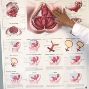 Taylour Paige Instagram - Just a girl, and the things that make up this beautiful life and pelvic floor therapy for endometriosis whomever needed to know and is struggling! I didn’t!