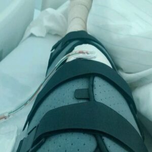 Telma Monteiro Instagram - Ontem fui operada ao joelho, pelo Dr. Pereira de Castro e a sua equipa, felizmente correu tudo bem! Foi o 1º dia, de um  percurso longo e exigente.

Desde a lesão no campeonato da europa, tenho estado num processo de assimilação, de encontrar o meu bem estar emocional e planeamento para o que se segue.

Tenho consciência que vão existir altos e baixos emocionais ao longo desta jornada. Vai ser tudo diferente do que imaginei. Mas também tenho a certeza que estou rodeada pelos melhores médicos, fisioterapeutas, clube, amigos, família, treinadores, colegas. E que como já demonstrei inúmeras vezes, não me faltará resiliência!

O meu pensamento está em tudo o que tenho de fazer, pra que tudo dê certo! E sei que vai dar!

Sou muito grata por todos os que me rodeiam e por todos os que me enviam energia positiva ❤

No fim vamos sorrir!
Vamos fazer história!
#paris2024 #navidacomgarra #planoa