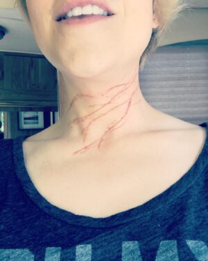 Tina Majorino Instagram - Haven’t done a throwback in a minute! Found these pics I sent to “your mom” from #Scorpion when Flo gets attacked by jellies. This episode was so fun. You know ya girl loves special fx makeup, stunts, and full circle career moments in which I get to pretend to do something that actually happened several times IRL when filming something else 😬 ((Also, why is there no gd jellyfish emoji?)) #tbt #FakeOuchies #Corpod #Florence