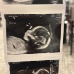 Valentine Thomas Instagram - Expectations vs. Reality 😂💙 Well, I guess life got real for @danielf86 and I 5 months ago! When I got super sick over the holidays, I decided to go do some blood tests to make sure everything was ok. When they asked me if I wanted to check if I was pregnant I said “nah it’s not that, I’m loosing too much weight!”. Well, it was that ha! At 36yo, considered “geriatric” pregnancy wise and catching Listeria in Nicaragua, I, we wanted to cherish the news for a while and honestly, process that after 36 years of doing what the heck we both wanted, life isn’t about us anymore, and will never be again. We are insanely excited to expect a little girl, and can’t wait to teach her how to fish, drive manual, snowboard, surf, catching her own food and a lot more!! Although if she is half the pain I was as a kid, good luck to us 😂 hopefully she will have Daniel’s personality and not my sass 🙃