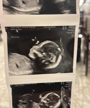 Valentine Thomas Instagram - Expectations vs. Reality 😂💙 Well, I guess life got real for @danielf86 and I 5 months ago! When I got super sick over the holidays, I decided to go do some blood tests to make sure everything was ok. When they asked me if I wanted to check if I was pregnant I said “nah it’s not that, I’m loosing too much weight!”. Well, it was that ha! At 36yo, considered “geriatric” pregnancy wise and catching Listeria in Nicaragua, I, we wanted to cherish the news for a while and honestly, process that after 36 years of doing what the heck we both wanted, life isn’t about us anymore, and will never be again. We are insanely excited to expect a little girl, and can’t wait to teach her how to fish, drive manual, snowboard, surf, catching her own food and a lot more!! Although if she is half the pain I was as a kid, good luck to us 😂 hopefully she will have Daniel’s personality and not my sass 🙃