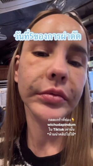 Vichuda Pindum Instagram - กดตะกร้าที่ช่อง👇
wichudapindum
ใน Tiktok เท่านั้น
*ห้ามนำคลิปไปใช้*
ลิ้งค์สั่งซื้ออยู่ในสตอรี่นะคะ