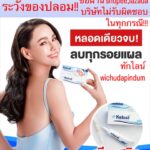 Vichuda Pindum Instagram – 💥Promotion ราคาพิเศษ หมดแล้วหมดเลย💥
.
Kelosil 3 หลอด จากปกติราคา 2,900.-
💙พิเศษ 3 หลอด 999.-💙 พร้อมจัดส่งฟรี
👉🔴 ทักไลน์ wichudapindum 🔴

🔥🔥Promotion พิเศษฉลอง 20 ปี🔥🔥 Kelosil ลดรอยแผลเป็น‼ 
เจลลดรอยแผลเป็นแบบ “ เคลือบ “ 
!!!! ท้าให้ลอง👍🏻💗
.
สามารถทาที่ไหนได้บ้าง ❓
✅ แผลคีลอยด์
✅ แผลเป็นทุกชนิด
✅ แผลพุพอง(ที่หายสนิทแล้ว)
✅ แผลผ่าตัด
✅ แผลหลุมสิว
✅ แผลนูนแดง
✅ แผลจากอุบัติเหตุ