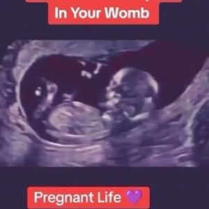 Adolfo Cubas Instagram - NO AL ABORTO