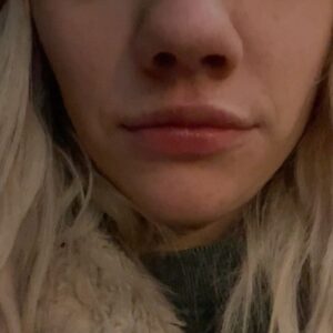 Áine Rose Daly Instagram - Here’s my selection of shit that happened over the festive period please enjoy x