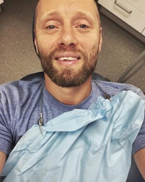 Aksel Hennie Instagram - 😁 FRONT TEETH GAP TIME! 😁  For the next project you will see me in, I went through a crazy transformation that I can’t wait to show you, guys! Until that movie premieres I’m not allowed to show you the result, but this week we’re doing some additional shooting, so here I am again at my dentist chipping off parts off my teeths to get the right diastema for the guy I’m playing.... ps; I would like to thank the guy that punched my face back in the days and made it easier for me to get the right look for this part... ❤️ #tannlegeneivika #artpro @gadinjoz #movie #moviemaking #dentaltransformation