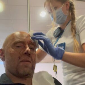 Aksel Hennie Instagram - ACCIDENT ON SET! ….just another example on the obvious fact that life is filled with risk. We can try to blame ourselves or others, make rules or whatever else to try to regulate consequences of our actions, but accidents will continue to happen as long as human beings are involved… #life #sisu #shootingmovies #actorlife