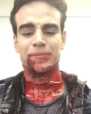 Alberto Rosende Instagram - SPOILER! This is taking off the prosthetics involved in making the threat slit look real! Our prosthetics team is incredible! Thank you all for watching tonight, can't wait for June 5th so we can continue this journey! #shadowhuntersseason2 #simonsthroatslit #bloodymess