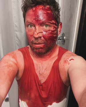 Alex Vincent Instagram - Don’t worry… the operation won’t take long, and you’ll be much better in the morning! Chucky Season 3! (These are all shots from filming part 1 this summer) #chuckyseries #friendstilltheend #dreamalittledreamofme