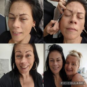 Alison Law Instagram - Losing weight really took its toll on my face and although I've always been confident I began to notice how I'd stopped taking photos and started avoiding being in them.

I've always been one for embracing growing old gracefully and I'd never considered Botox or what it could do for me... Until I met @beautifications.melissa Melissa has been Harley Street trained in Aesthetics told me that I didn't have to put up with how the weight loss had effected my face and with a few small injections in key points around my face and eyes I'd look 10 years younger!!! 

Obviously I was intrigued and thought sod this I'm giving it a go! I have to say I've not looked back, the amazing work Melissa has done truly speaks for itself. 

Now I feel after a little magic youth due from Melissa it has empowered me and my only regret is that I'd never had it done sooner! 
If you're considering trying this and you're around the Essex area you need to book up with this absolute genius ✨✨✨ 

Special offers running on @beautifications.melissa
www.beautifications.co.uk
Email: melissa@beautifications.co.uk
WhatsApp: 07956523960 

*Paid post*

#botox #aesthetics #essex #selflove #selfcare #harleystreet #uk #london #skin #confidence #confidentwomen #instabeauty #glowup #weightloss #bypassed