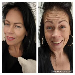 Alison Law Instagram - Losing weight really took its toll on my face and although I've always been confident I began to notice how I'd stopped taking photos and started avoiding being in them.

I've always been one for embracing growing old gracefully and I'd never considered Botox or what it could do for me... Until I met @beautifications.melissa Melissa has been Harley Street trained in Aesthetics told me that I didn't have to put up with how the weight loss had effected my face and with a few small injections in key points around my face and eyes I'd look 10 years younger!!! 

Obviously I was intrigued and thought sod this I'm giving it a go! I have to say I've not looked back, the amazing work Melissa has done truly speaks for itself. 

Now I feel after a little magic youth due from Melissa it has empowered me and my only regret is that I'd never had it done sooner! 
If you're considering trying this and you're around the Essex area you need to book up with this absolute genius ✨✨✨ 

Special offers running on @beautifications.melissa
www.beautifications.co.uk
Email: melissa@beautifications.co.uk
WhatsApp: 07956523960 

*Paid post*

#botox #aesthetics #essex #selflove #selfcare #harleystreet #uk #london #skin #confidence #confidentwomen #instabeauty #glowup #weightloss #bypassed