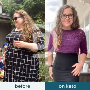 Andreas Eenfeldt Instagram - 🌟 Success story 🌟⁠
⁠
Robbie from Toronto struggled with her weight most of her adult life but one day, she decided she'd had enough. ⁠
⁠
She took matters into her own hands and switched to a ketogenic diet. Not only did she lose 175 pounds (79 kilos), her health has improved in countless ways. Way to go, Robbie! 👏 ⁠
⁠
Read Robbie's full story and advice 👉 @diet_doctor⁠
.⁠
.⁠
.⁠
.⁠
.⁠
.⁠
.⁠
.⁠
.⁠
#health #wellness #selfcare #motivation #healthy #healthylifestyle #selflove #nutrition #lifestyle #inspiration #healthyliving #wellbeing #healthyfood  #dietdoctor #cooking #delicious #lowcarb  #lchf #glutenfree #ketodiet #ketogenic #fitfood #weightloss #keto #eatclean #food #foodie #recipes #ketodinner #ketolunch