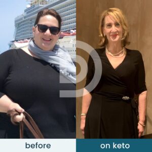 Andreas Eenfeldt Instagram - For 40 years, Amy struggled. She followed advice from countless experts, but nothing worked. If she lost a bit of weight, she would regain it. ⁠
⁠
But things turned around for Amy when she discovered the low carb diet and Diet Doctor. Amy has lost 230 pounds (104 kilos) since starting her low carb journey and is still going strong four years on!⁠
⁠
Congratulations, Amy! 👏 ⁠
⁠
Read Amy's full updated story and see what else she's been up to; 👉 you'll find the link in our bio @diet_doctor⁠
.⁠
.⁠
.⁠
.⁠
.⁠
.⁠
.⁠
.⁠
.⁠
.⁠
.⁠
#health #wellness #selfcare #motivation #healthy #healthylifestyle #selflove #nutrition #lifestyle #inspiration #healthyliving #wellbeing #healthyfood  #dietdoctor #cooking #delicious #lowcarb  #lchf #glutenfree #ketodiet #ketogenic #fitfood #weightloss #keto #eatclean #food #foodie #recipes