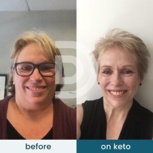 Andreas Eenfeldt Instagram - When Elizabeth was told there was no medical treatment for a rare genetic disease she had been suffering with most of her life, she turned to keto. ⁠
⁠
Five years on, Elizabeth is symptom-free, has lost 51 pounds (23 kilos), and is in better health than ever. How does she maintain it? Elizabeth lifts weights and emphasizes protein in her meals. 💪 "I don't look like a sick person; I look like an athlete." ⁠
⁠
Read more about Elizabeth's inspiring story 👉 @diet_doctor ⁠
.⁠
.⁠
.⁠
.⁠
.⁠
.⁠
.⁠
⁠
#dietdoctor #lchf #glutenfree #ketodiet #ketogenic #fitfood #weightloss #keto #eatclean #food #healthyfood #tasty #healthy #eeeeeats #cookingram #foodie #recipes #ketodinner #ketolunch #lowcarblife #highersatiety #